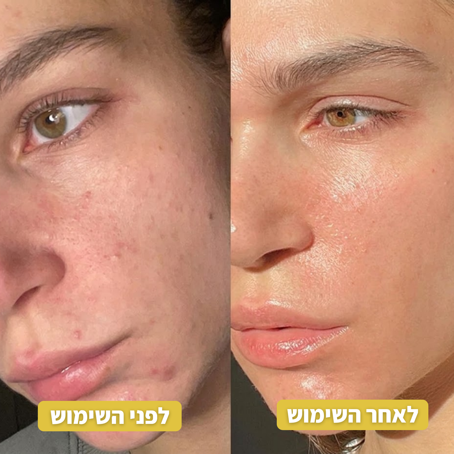 Infuse™ פתרון האנטי-אייג'ינג הביתי