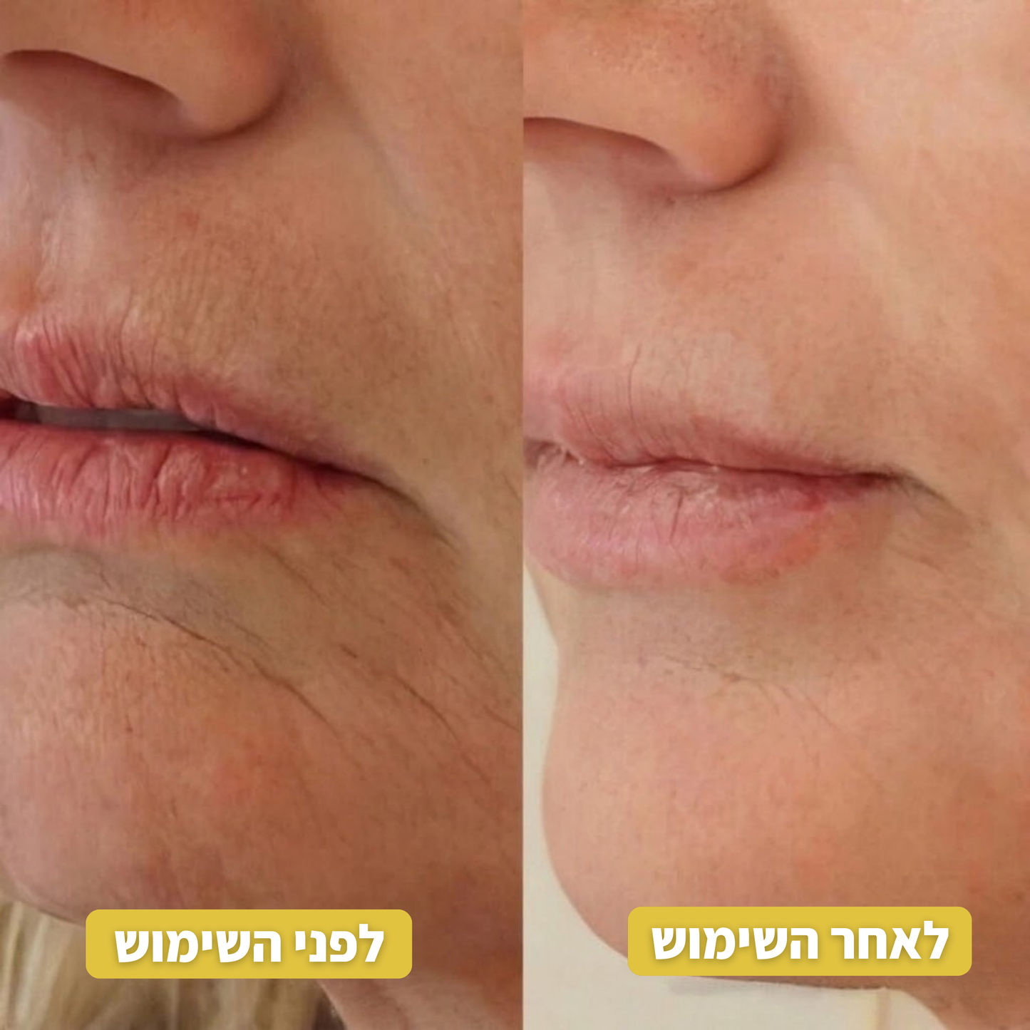 Infuse™ פתרון האנטי-אייג'ינג הביתי