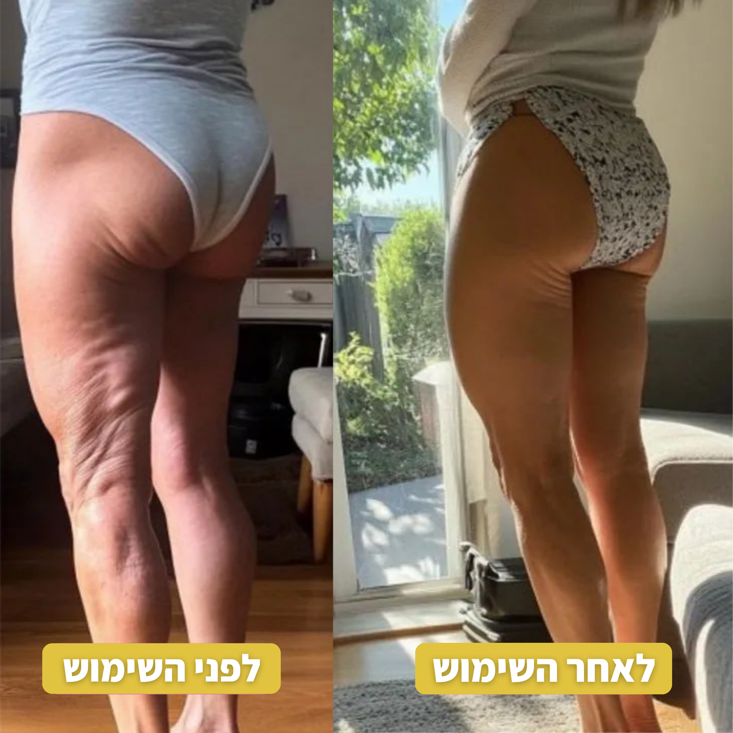 NURA™ הפתרון לעור חלק וצעיר